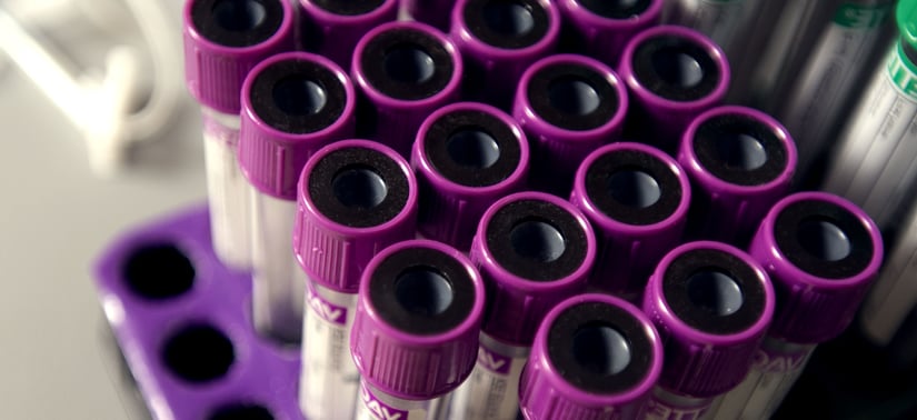 purple-topped-tubes-is-generally-used-when-running-blood-analysis-tests.jpg